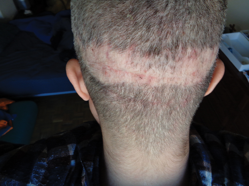 Дополнительные клинические фото осложнений