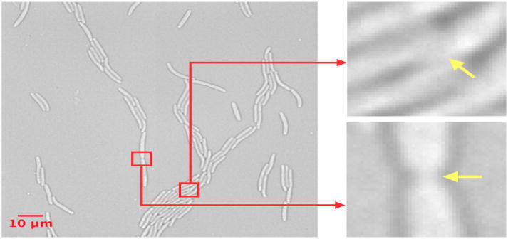 BHT — забор с тела для пересадки на скальп